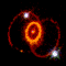 SN1987A_Rings.gif